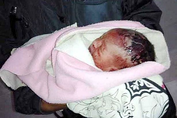The 2-hours old baby whose mother dumped naked in a dustbin was taken to the hospital where she is lying in a critical condition. (Photo Credit: Mirror UK)