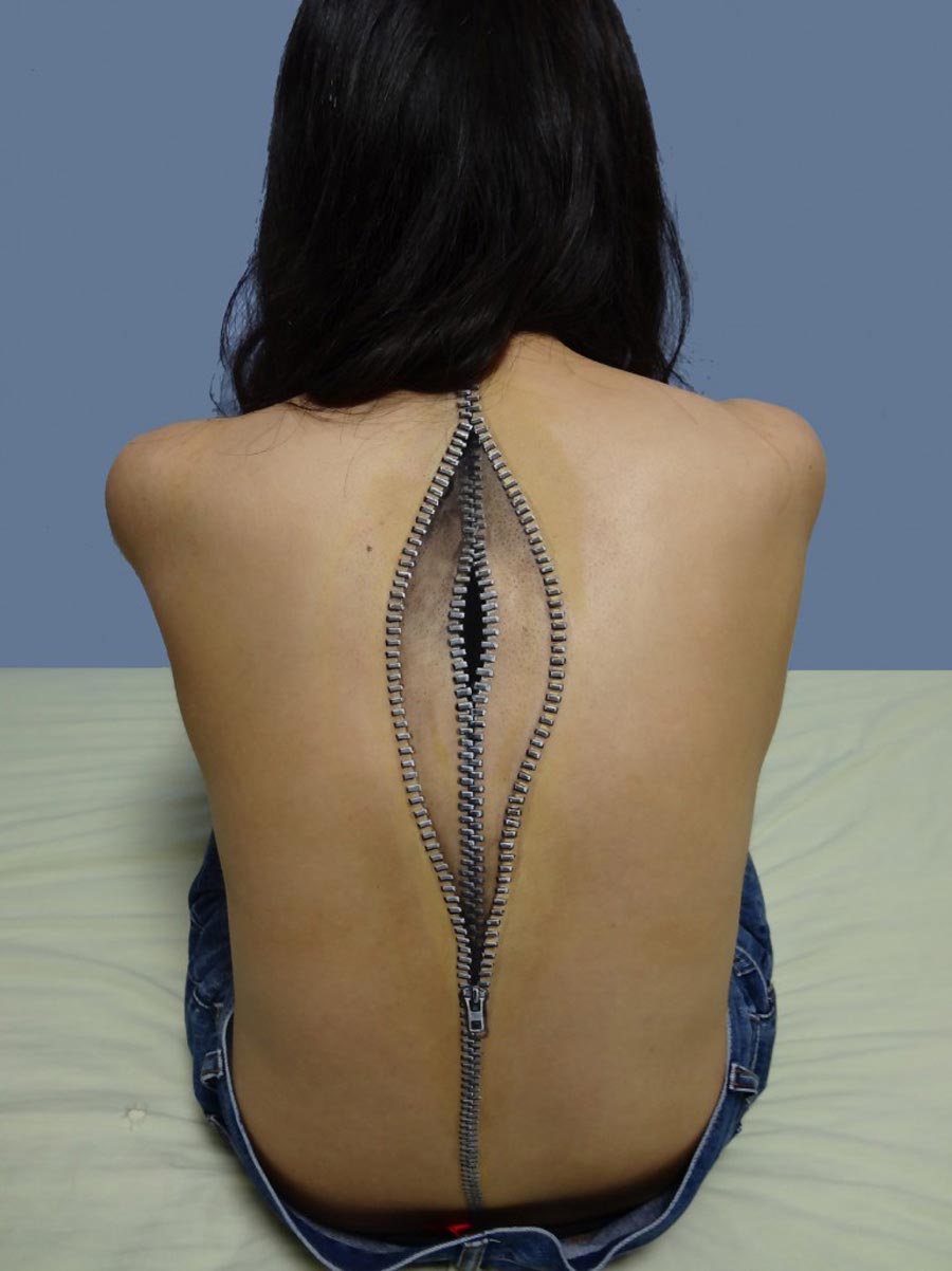 Source: Prafulla Japanese Artist Hikaru Cho (aka Chooo-San) has a keen eye for embedding a certain mechanistic realism into her body art. Blending the rigidity of zippers, screws and stitching with the flesh, Choo-San’s works are sometimes a bit unsettling.