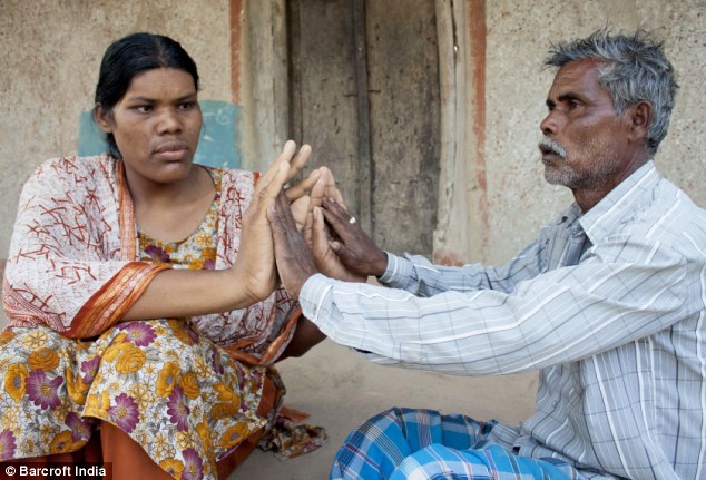 Coming back: Doctor's say that Siddiqa also needs psychological rehab to learn to integrate with others in her village now that the tumour is gone (Photo Credit: Daily Mail)