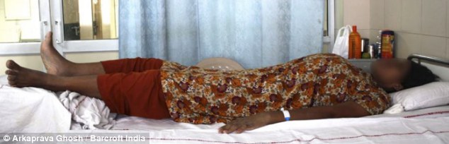 Condition improving: Staff at the Delhi hospital where Siddiqa is recovering have had to lengthen her bed with trolley (Photo Credit: Daily Mail)