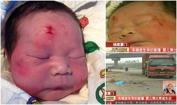 These are the incredible images of a miracle baby that was catapulted out from his pregnant mother as she was run over by a truck.