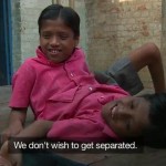 Conjoined-twins-Shivanath-and-Shivram-Sahu-in-India-dont-wish-to-get-separated_lg