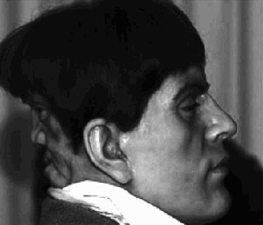 Edward Mordake