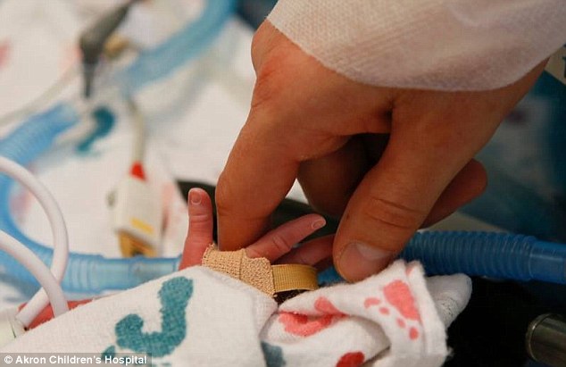 Touch: an adult hands touches one belonging to a tiny twin (Photo Credit: Akron Children's Hospital)