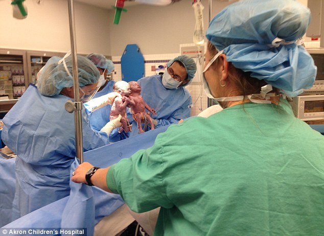 Jenna (pictured on the right) weighted 4 pounds 2 ounces and was 17 inches long. Jillian weighed 3 pounds 13 ounces and was 17 and 1/2 inches long. (Photo Credit: Akron Children's Hospital)