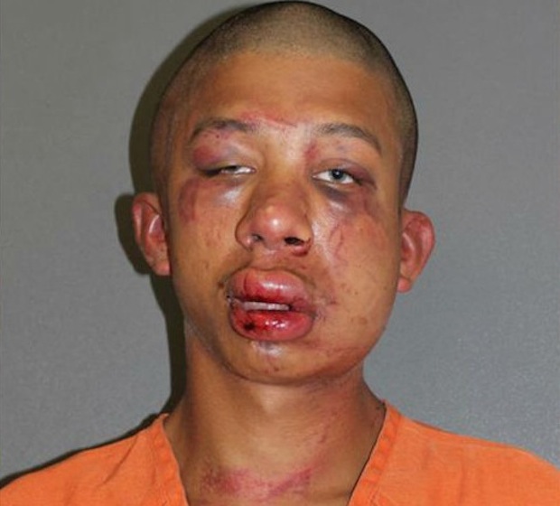 Raymond Frolander, the 18-year-old man beaten by a father after the dad claimed he saw him abusing his child. (Photo Credit: Volusia County Jail)