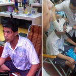 Knife-falls-from-sky-into-mans-head (2)