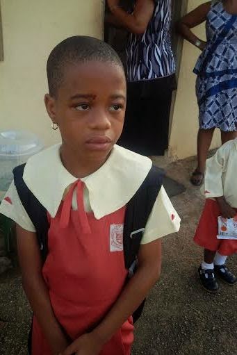  Blessing Osayande, a primary 2 pupil of  South Royal School in Benin city allegedly battered by a woman believed to be her father's girlfriend. (Photo Credit: Linda Ikeji)