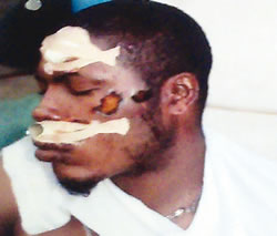 The battered barman, Simeon Tenebe (Photo Credit: Punch)