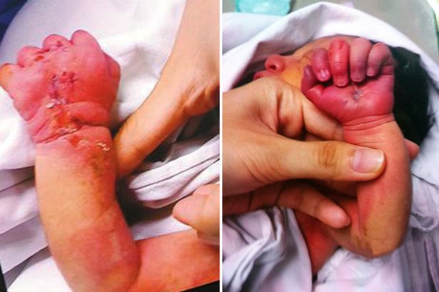 A woman was caught apparently trying to bite her baby's arm shortly after giving birth in China. (Photo Credit: CEN)