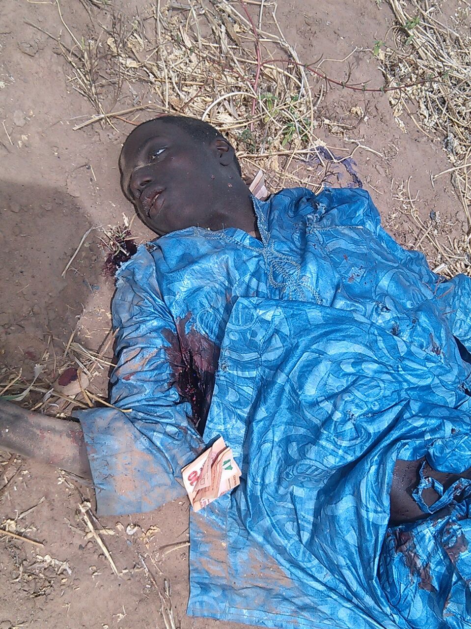 Remains of the suicide bomber. (Photo Credit: DHQ)