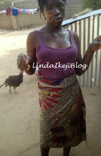 Ramatu was attacked by her elder sister with hot water after a heated argument. (Photo Credit: Linda Ikeji Blog)