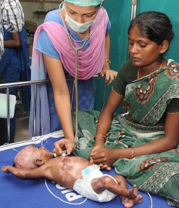 Indian baby who spontaneously bursts into flames (Photo Credit: Mail Online)