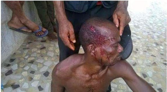 voter who was injured by thugs in akwa-ibom state (Photo credit: TheInfoNg)