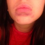 Kylie-Jenner-Lips-Gone-Wrong2- The Trent