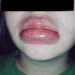Kylie-Jenner-Lips-Gone-Wrong4- The Trent