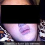 Kylie-Jenner-Lips-Gone-Wrong5- The Trent