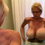 Breast implant4