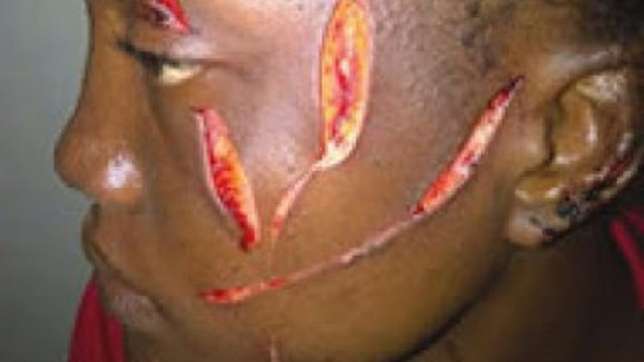 22-year-old woman, Mary Atiake, has used razor blade to cut the face of another woman, Sarah Ogunyemi, over allegation that she slept with her boyfriend identified only as Joe in Lagos State. (Photo Credit: Pulse)