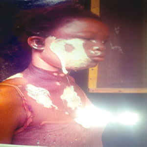 One 16-year-old Cecilia Ukpa on Tuesday, June 22, 2015 poured hot water on her senior colleague identified only as Albert (Pictured) following an argument in Lagos. (Photo Credit: Punch)
