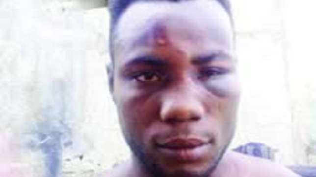 The victim, Segun Borokini, who was among the people attacked by a Lagos State monarch's son n Ajah area of the state.  (Photo Credit: Punch)