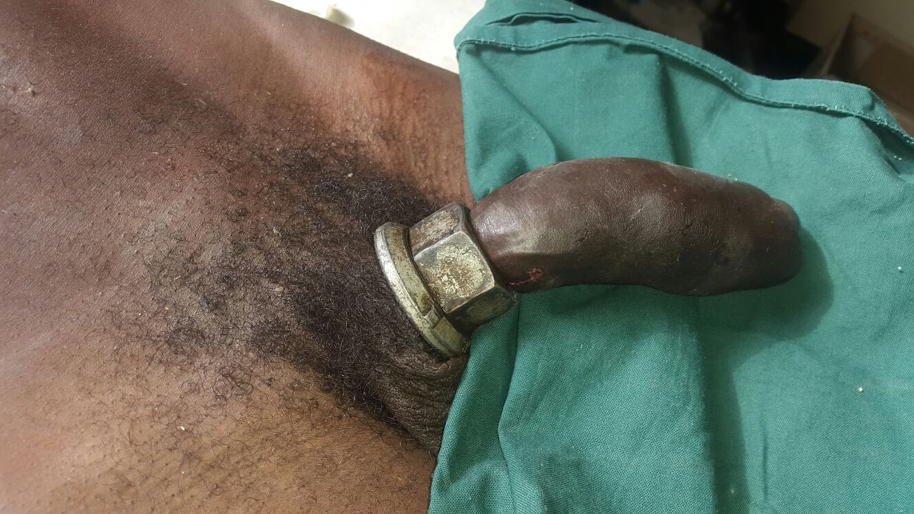 Penis With Ring 48