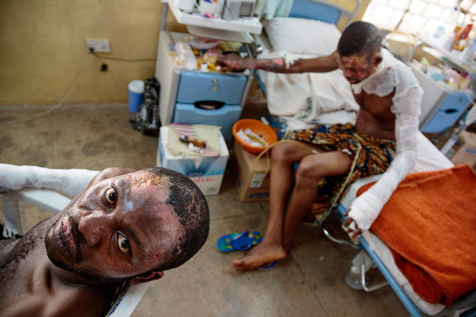 At the National Orthopedic Hospital, Christian survivors of a Boko Haram bomb attack on a bus depot on March 18, 2013 get free care, in Kano, Nigeria on March 29, 2013. Over 100 people died and scores were injured. | Ed Kashi 