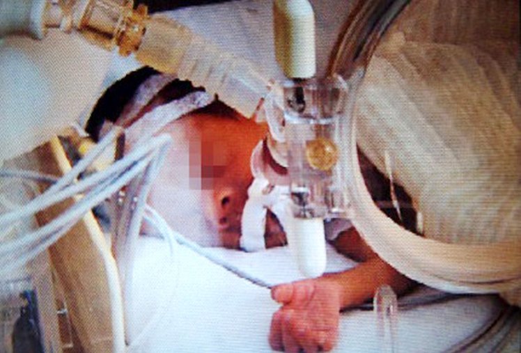 The boy had been previously kept in an incubator | CEN