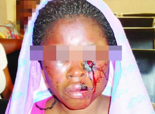 The mother of two who was assaulted by her husband on Monday, February 8, 2016 in the Surulere area of Lagos State |Punch