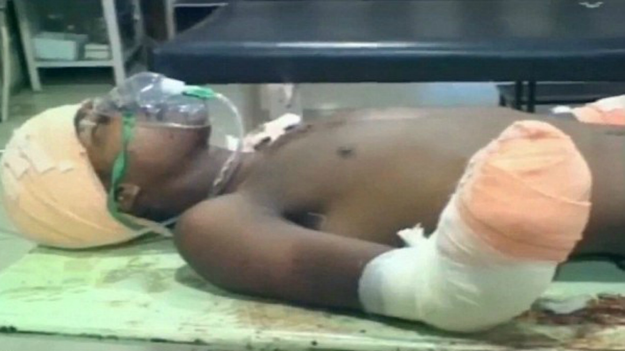 17-Year old boy had his hands chopped off by father of 7-month-old baby girl who he raped | CEN