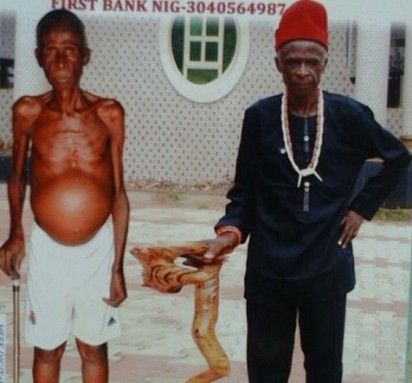 Veteran Nollywood actor, Martins Njubuigbo, reportedly diagnosed with liver disease in Lagos State