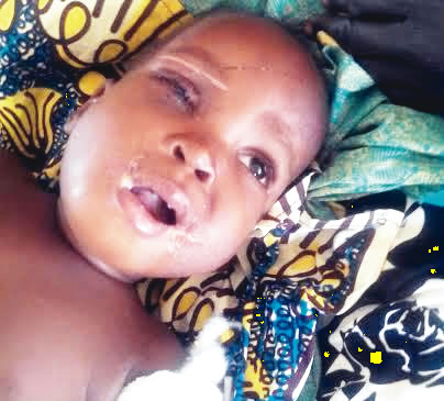 Musa Murtala had his eye, tongue, private part removed by his grandmother and stepmother in Kano State | Punch