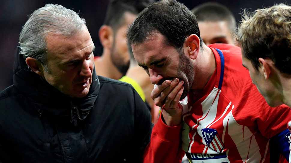 Atletico Defender Godin Loses 3 Upper Teeth After Bad Collision