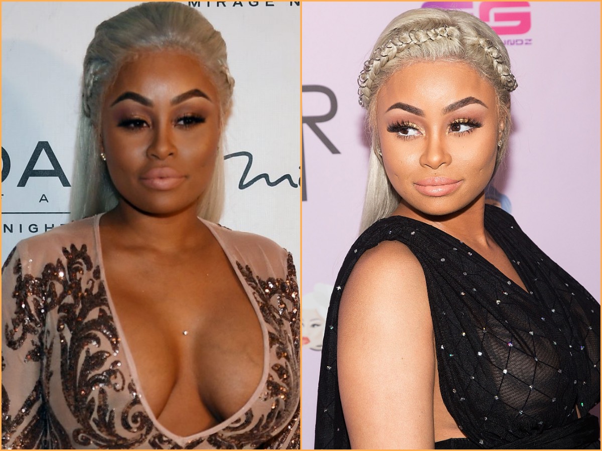 Blac Chyna (Before and After) photos