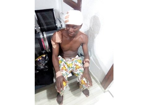 Buhari Supporter Been Stabbed on the Head 