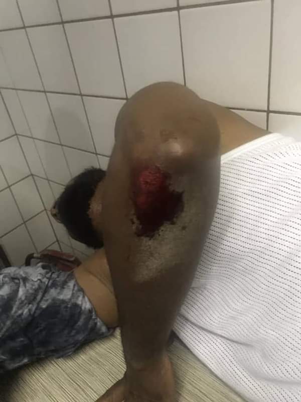 Deji Adeyanju attacked by pro-Buhari thugs at the National Human Rights Commission (NHRC) in Abuja, Dec 23, 2019
