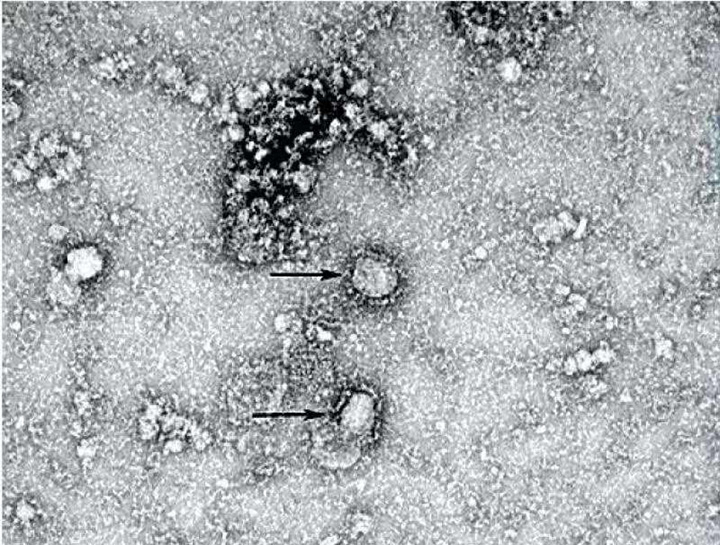 Coronavirus Pneumonia Outbreaks In China