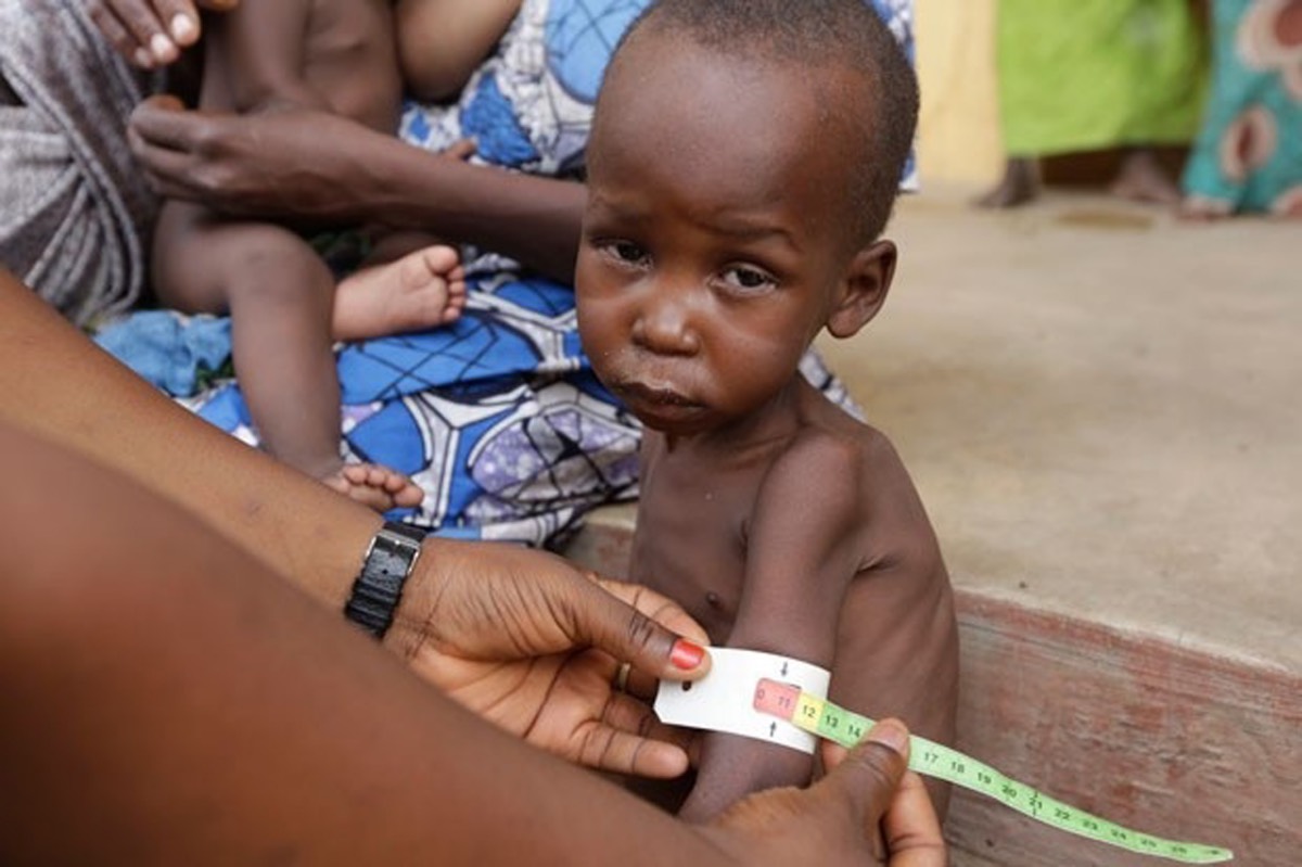 Boko Haram, Child, UNICEF, Malnutrition