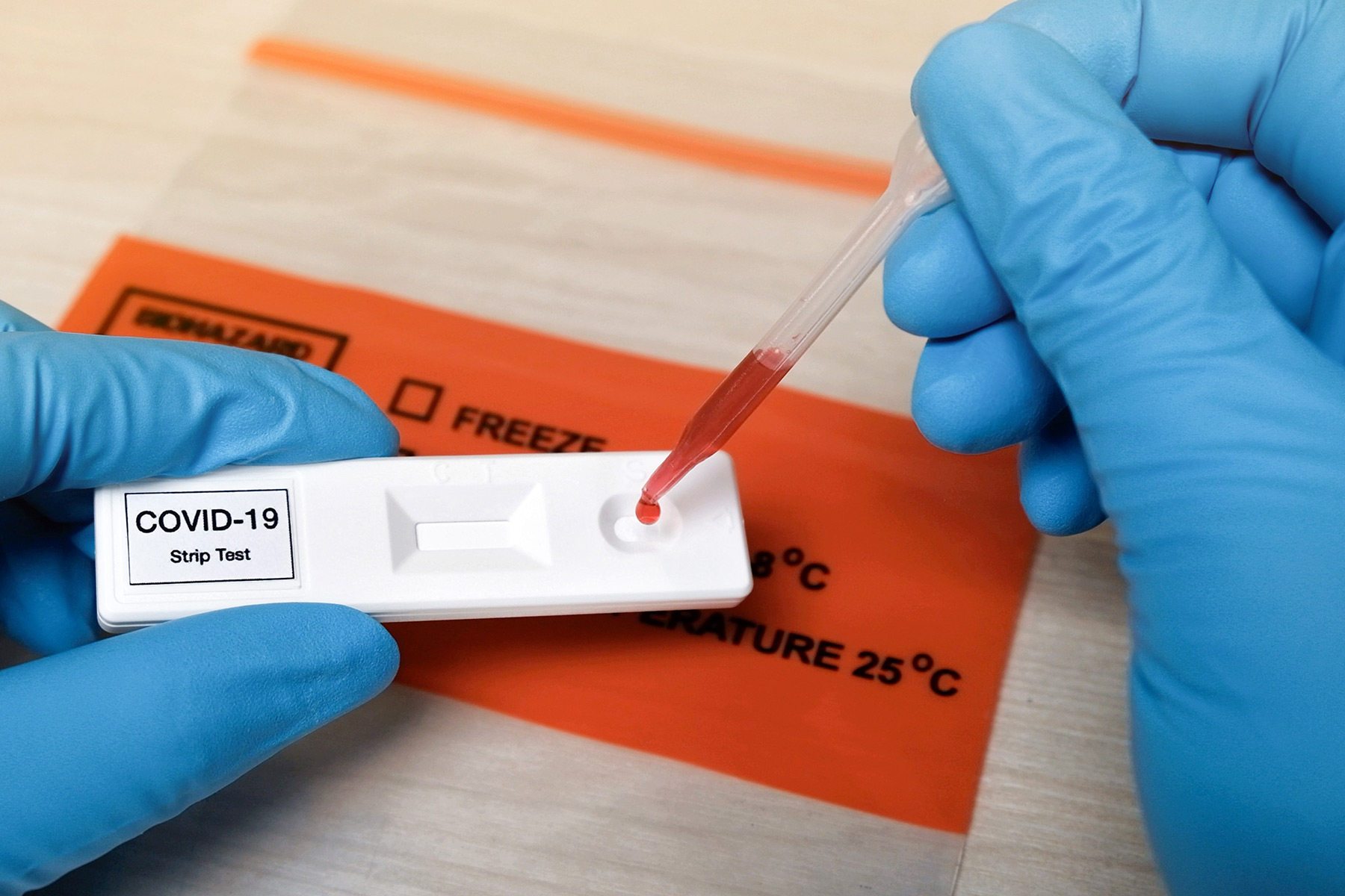 COVID-19 TEST, coronavirus