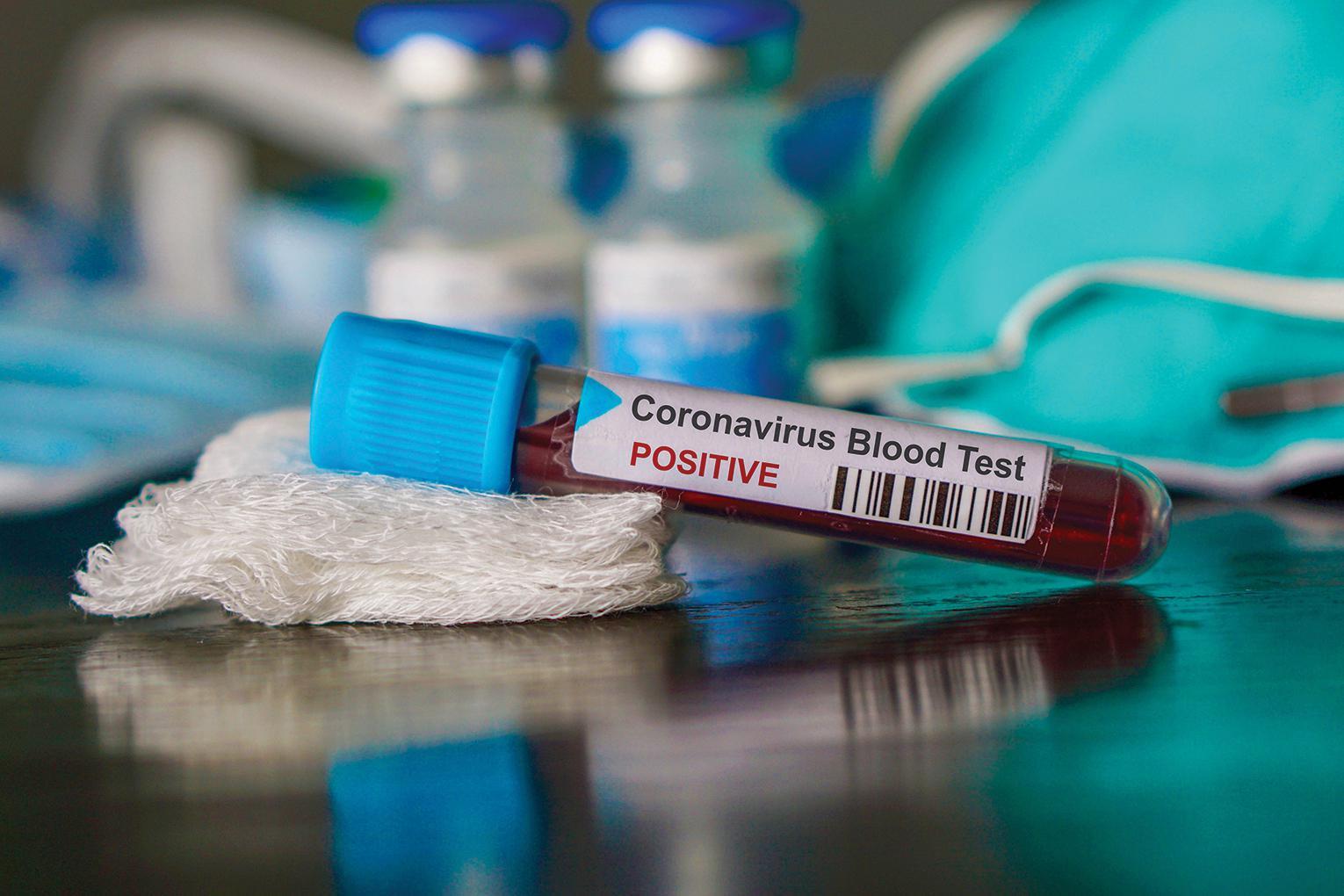 COVID-19 TEST, coronavirus asthmatic